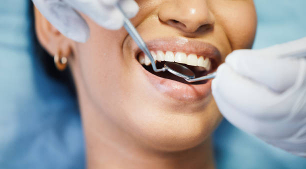Best Urgent Care for Lost Fillings or Crowns in Ivyland, PA