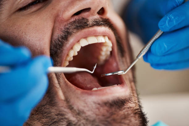 Best Emergency Treatment for Dental Infections or Abscesses in Ivyland, PA